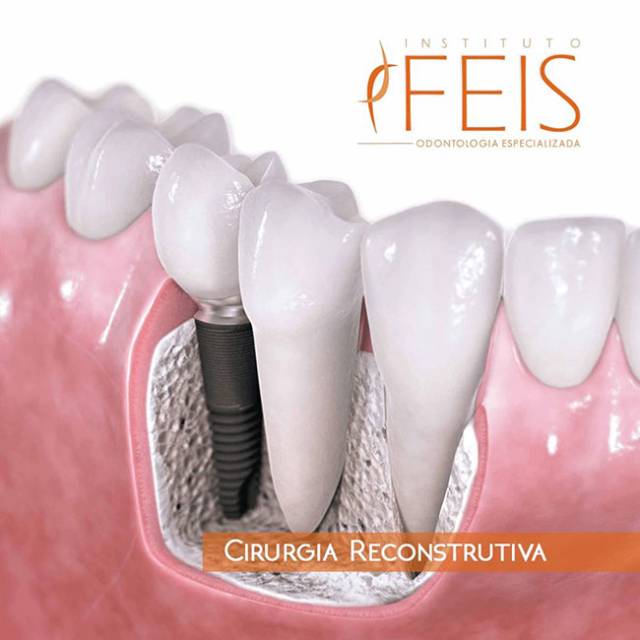 Instituto Feis - RT Dr. Ricardo Feitosa CRO-SP 77583
